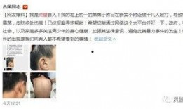 德善弟弟爆料视频合集下载,揭秘幕后故事与精彩瞬间